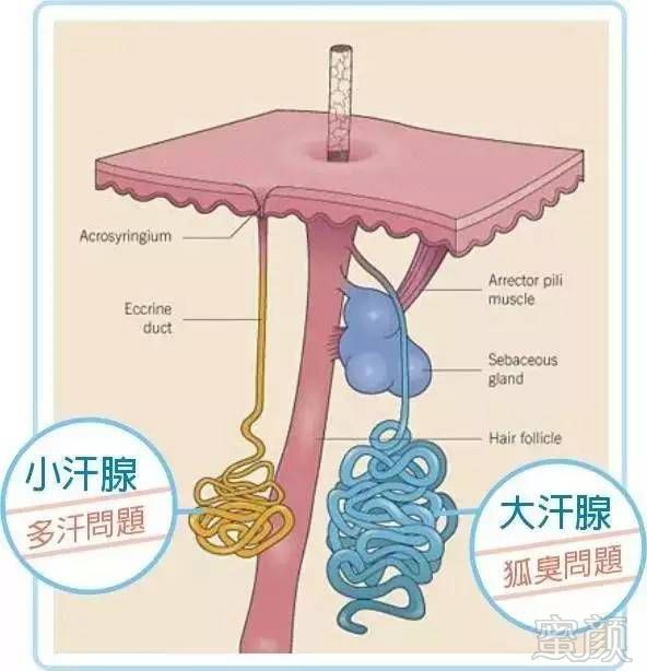 腋臭不是病,臭起来真要命!