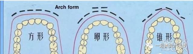 牙齿矫正=整容?