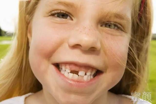 孩子并没有"丑牙期",孩子牙齿长不齐要注意了!