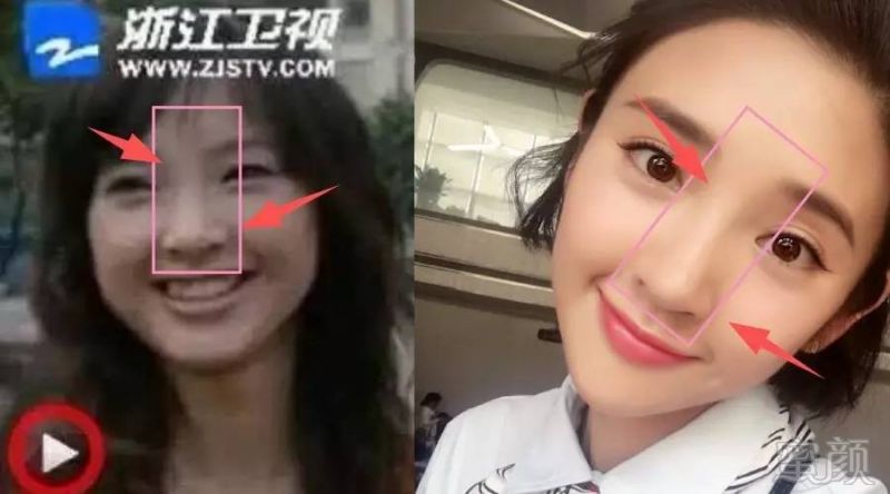 为什么唐艺昕整容整牙,却仍被卓伟称为娱乐圈"蕞干净女星"?