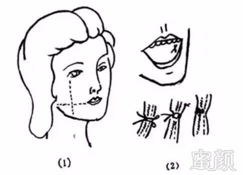 笑起来比许晴更迷人的她,酒窝竟然是戳出来的?