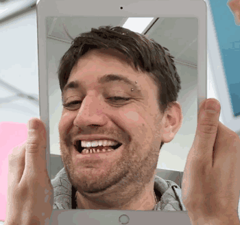 比如这位哥们儿的一口烂牙,     先自拍一张