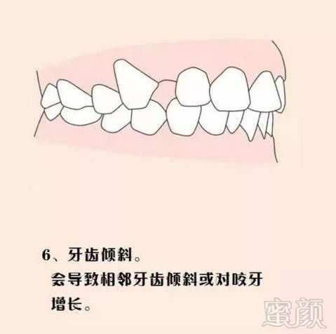 1,容易形成龋齿及牙周病       牙列不齐,即使再认真的刷牙,也