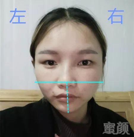 妹纸脸型上的bug还是比较明显的,左右脸是妥妥的不对称,导致还有种