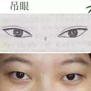 眼睛每天就好像没睡醒似的     侧面看鼓鼓的     肿泡眼在做双
