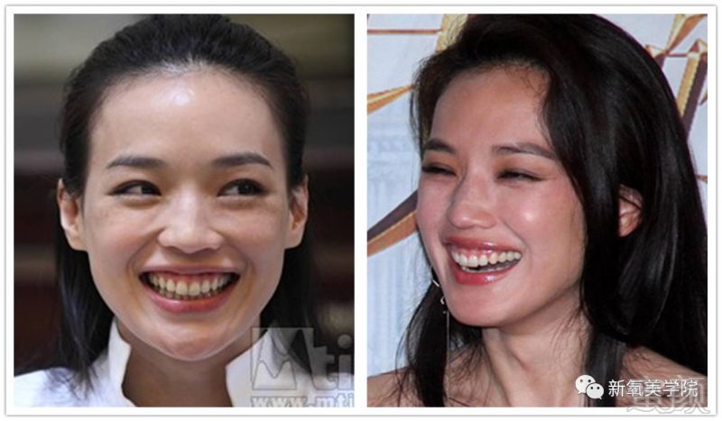 为什么雪莉依然美,刘亦菲却惨不忍睹     大表姐刘雯属于牙齿看起来