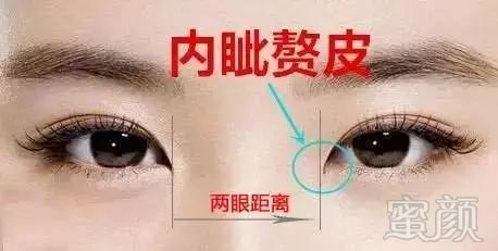 根据个人情况 通过开内眼角(祛内眦赘皮)或外眼角,调整眼裂眼