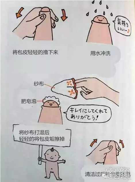 兄弟,放过你的包皮吧!