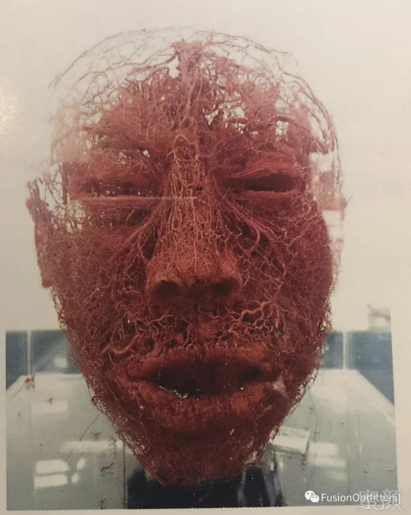 下图为人类面部的血管分布,密密麻麻,想不扎到血管都很难.