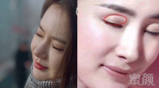 戚薇霸气公开割双眼皮,那些悄悄把眼睛变大的女明星有几个敢承认?