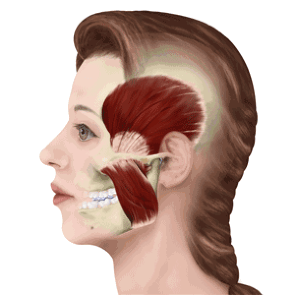 误区三:矫正的牙齿容易松动