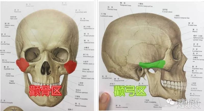 绝望的颧骨和颧弓,只有磨骨一条路?
