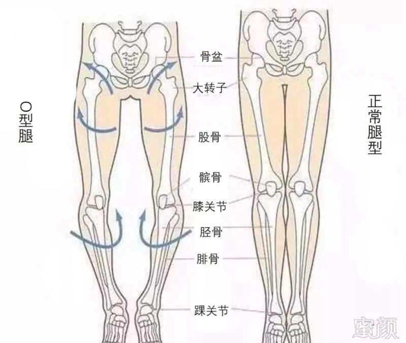 还在因为o型腿不敢穿短裙吗学会这几个动作轻松让你变美腿