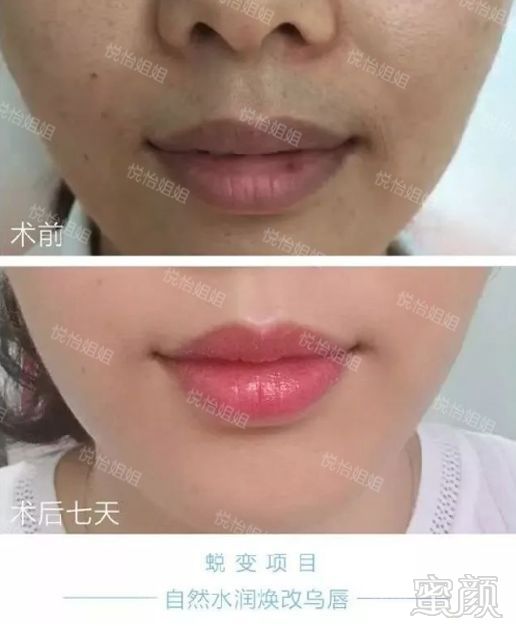 从唇部状态看健康,唇膏不上色的乌唇肿么办?