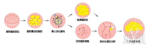 腹部皮下脂肪颗粒图片大全 Uc今日头条新闻网