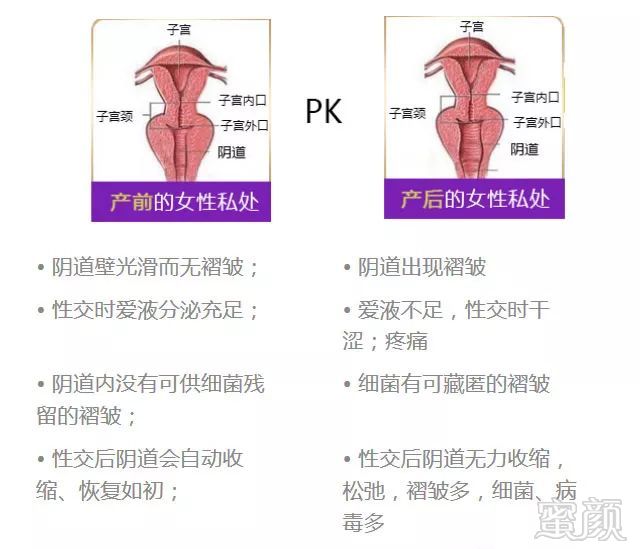 有明星也开始站出来,为私密整形代言.