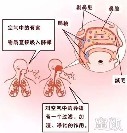 口呼吸造成的那些事儿