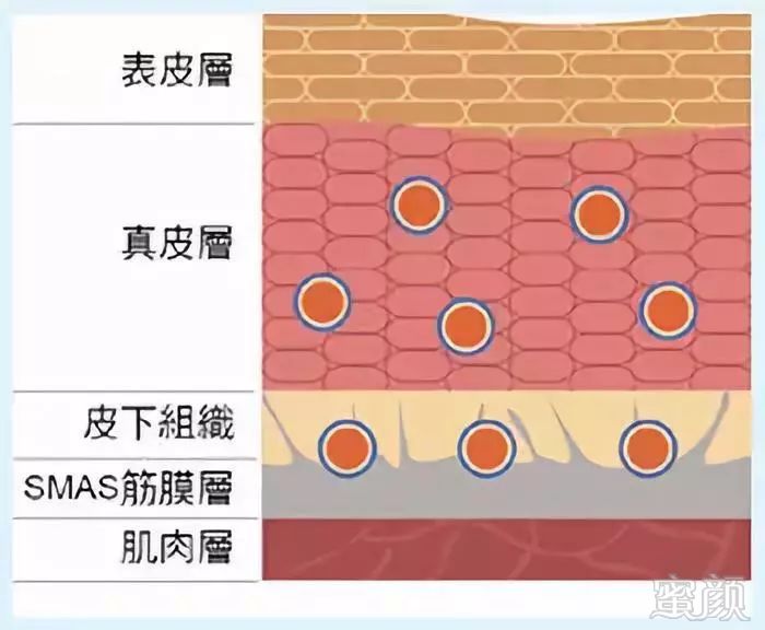 这样抗衰,真是"超热"的!