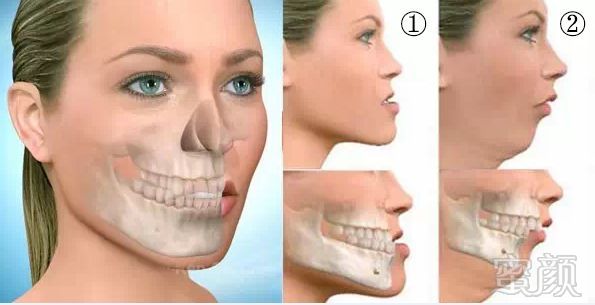 下颌骨的形状决定了脸型的基本轮廓