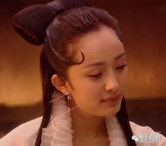 杨幂聂远削错下颌角脸垂出双下巴,为啥"一刀切"的李冰冰就没有后遗症?