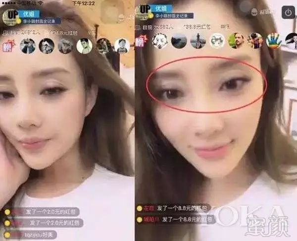 吐槽大会李小璐直言:"今天开眼角,明天丰唇,只要渠道安全"!