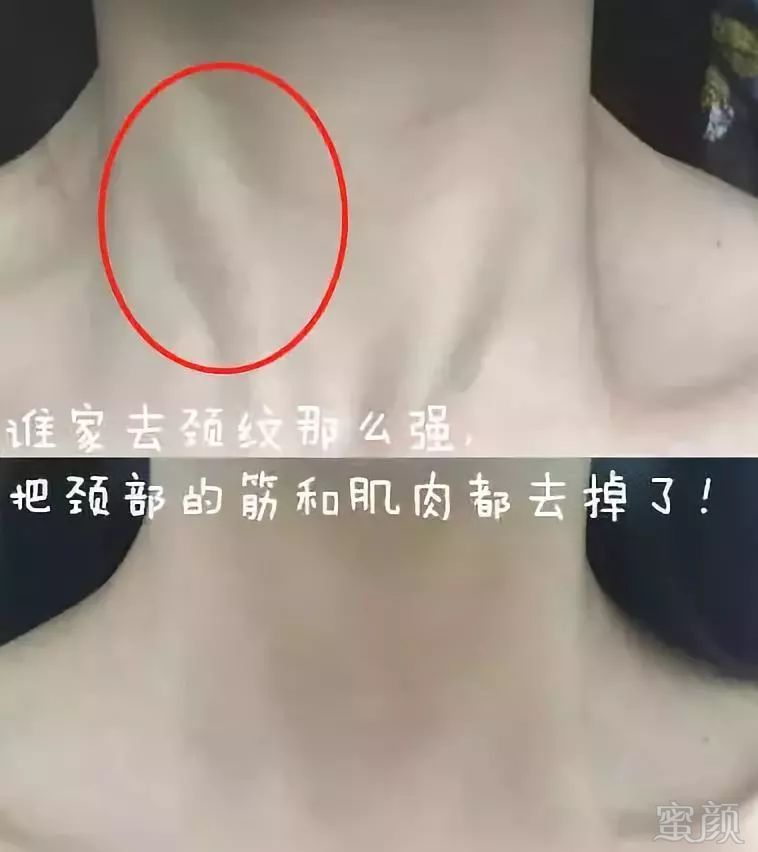 颈纹霜有效吗?看对比就知道了