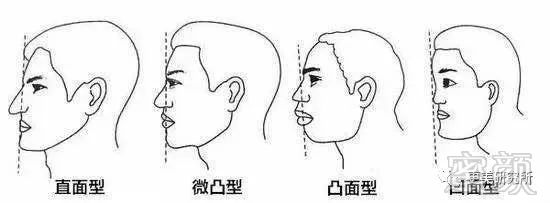 fa姐归纳总结了一下,影响侧脸美感包括面型,鼻额角,鼻唇角,下颌线这四