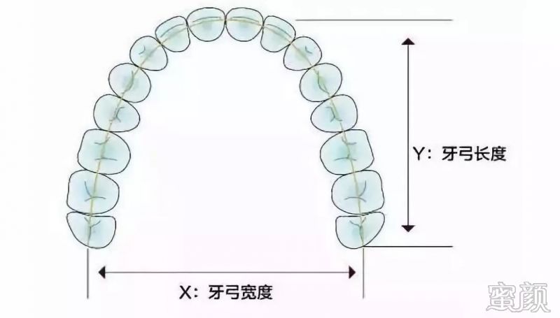 牙突正畸增牙弓,鼻尖下颏拉起美人线