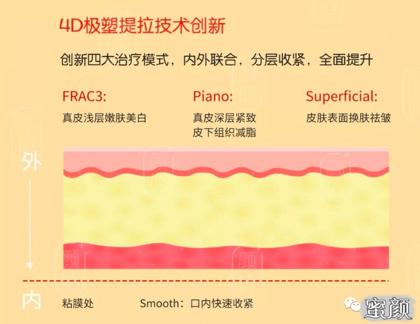 医美圈"抗衰三宝—热玛吉,fotona4d,赛诺秀5d,对于想要来抗衰保养