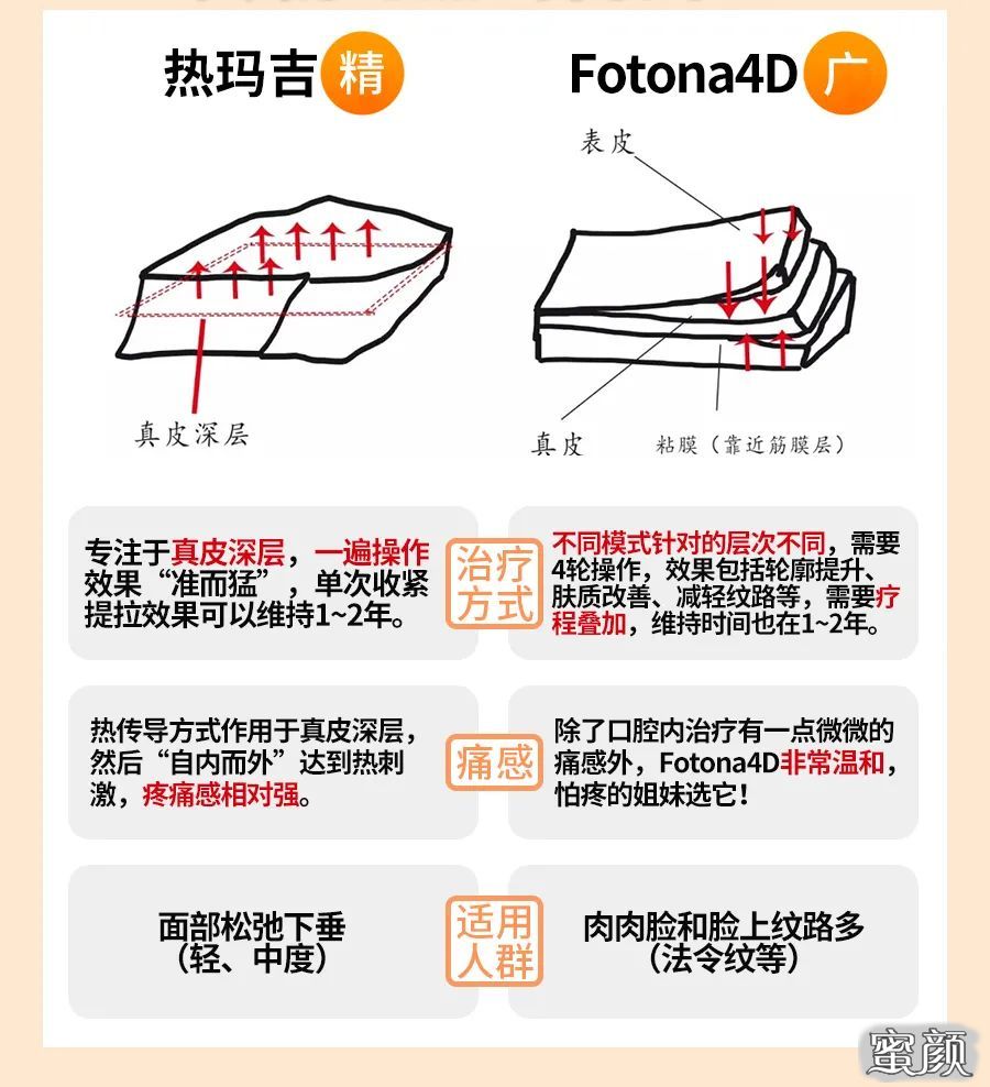 fotona 4d和热玛吉,谁才是抗衰界的no-1?