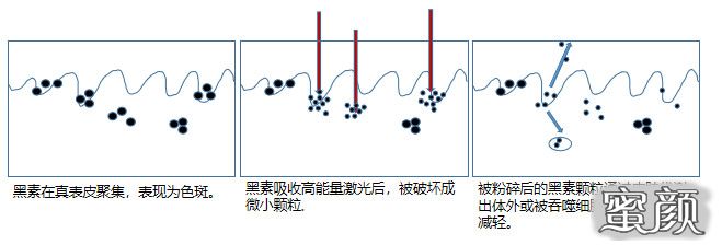 至于工作原理,q激光,皮秒激光和超皮秒激光的原理是一样的,都是