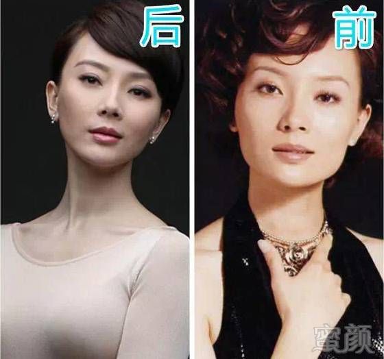 疑似整容部位:眼睛,下巴,颧骨,鼻子,脸型有了很大的变化 陈数