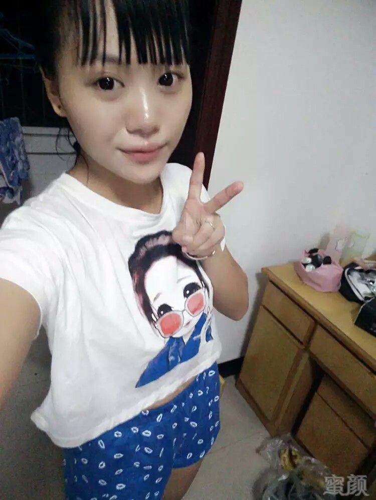 成都驻颜医学美容门诊部隆胸案例和效果图:我的胸部从