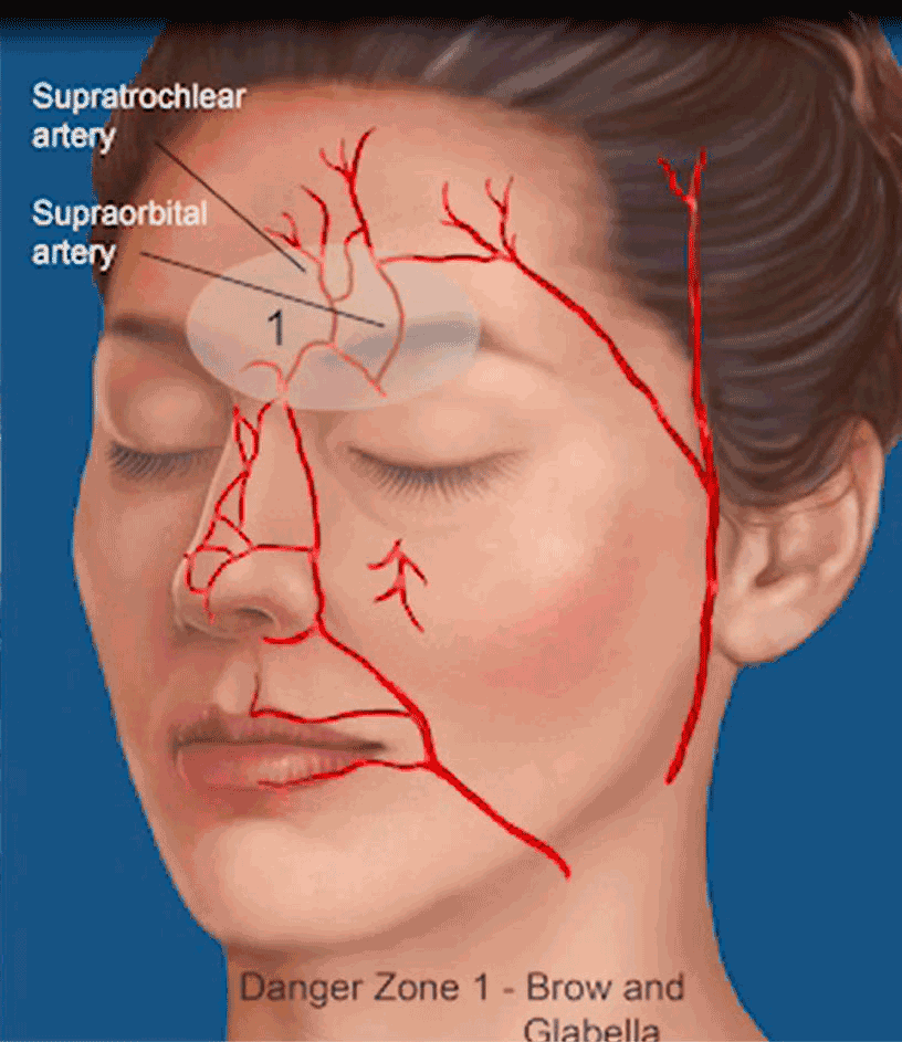 面部危险区域解剖填充注射安全蕞大化