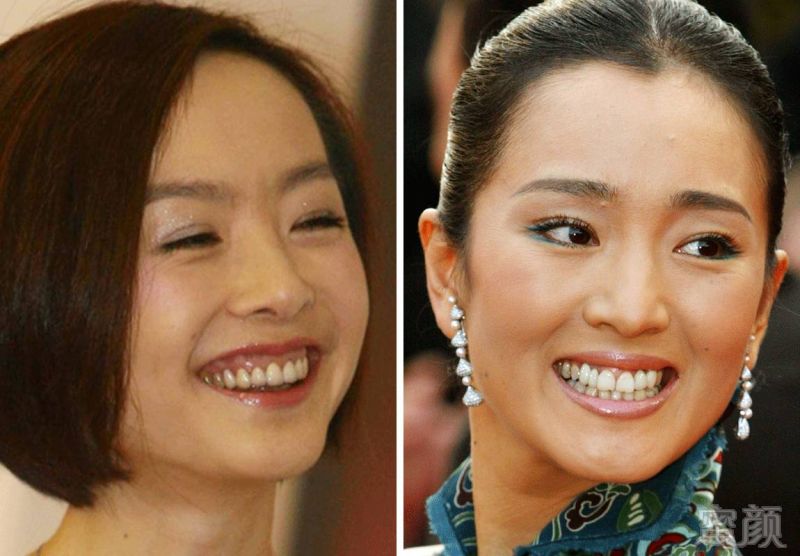 如何用肉眼识别明星的假牙?