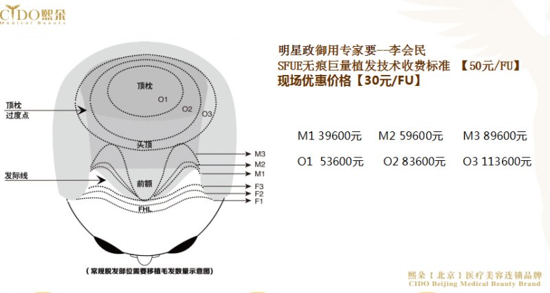 案例图片