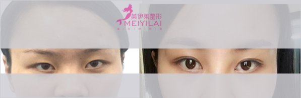 https://img.miyanlife.com/Editor/2016-11-08/582199a34a7ad.jpg
