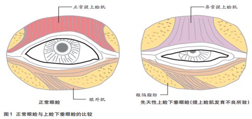 案例图片