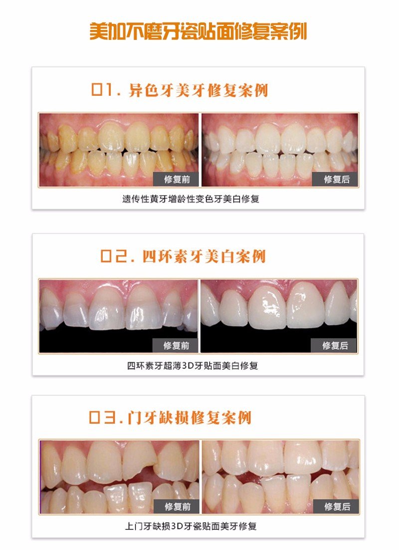 https://img.miyanlife.com/mnt/Editor/2017-07-17/596c48fe0cd48.jpg