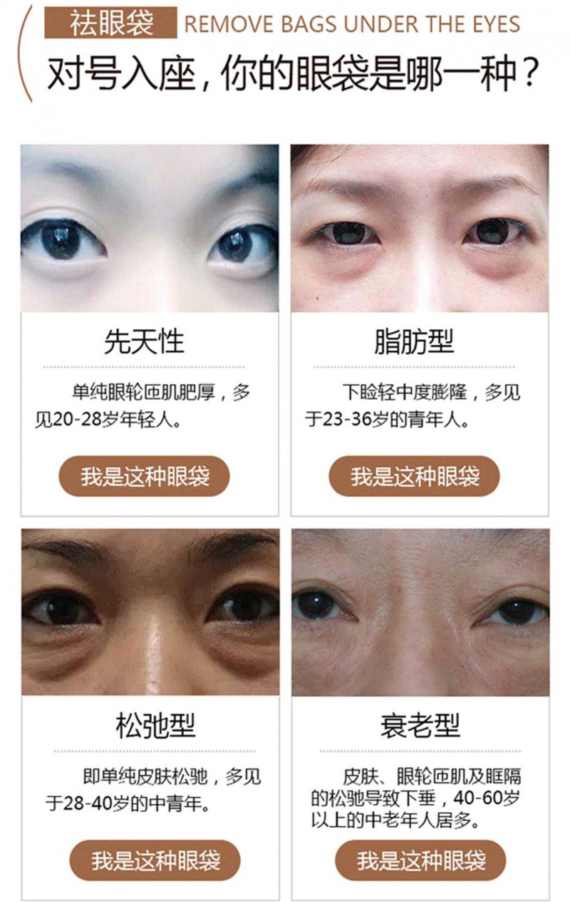 https://img.miyanlife.com/mnt/Editor/2017-08-02/5981665fae042.jpg