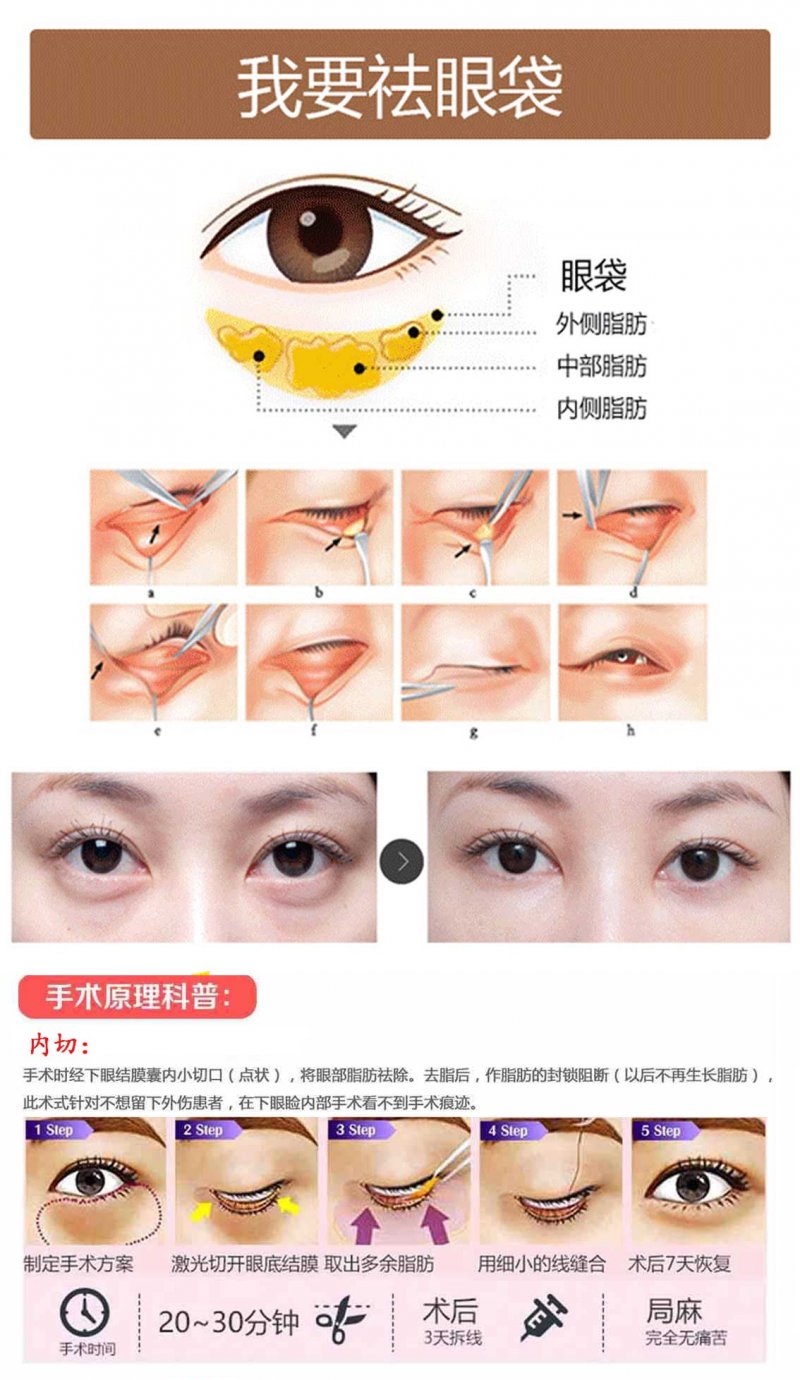 https://img.miyanlife.com/mnt/Editor/2017-08-02/598166607eb29.jpg