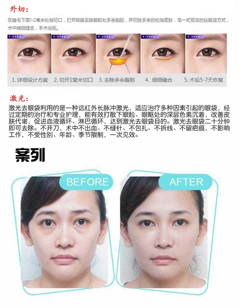 https://img.miyanlife.com/mnt/Editor/2017-08-02/5981666137de7.jpg