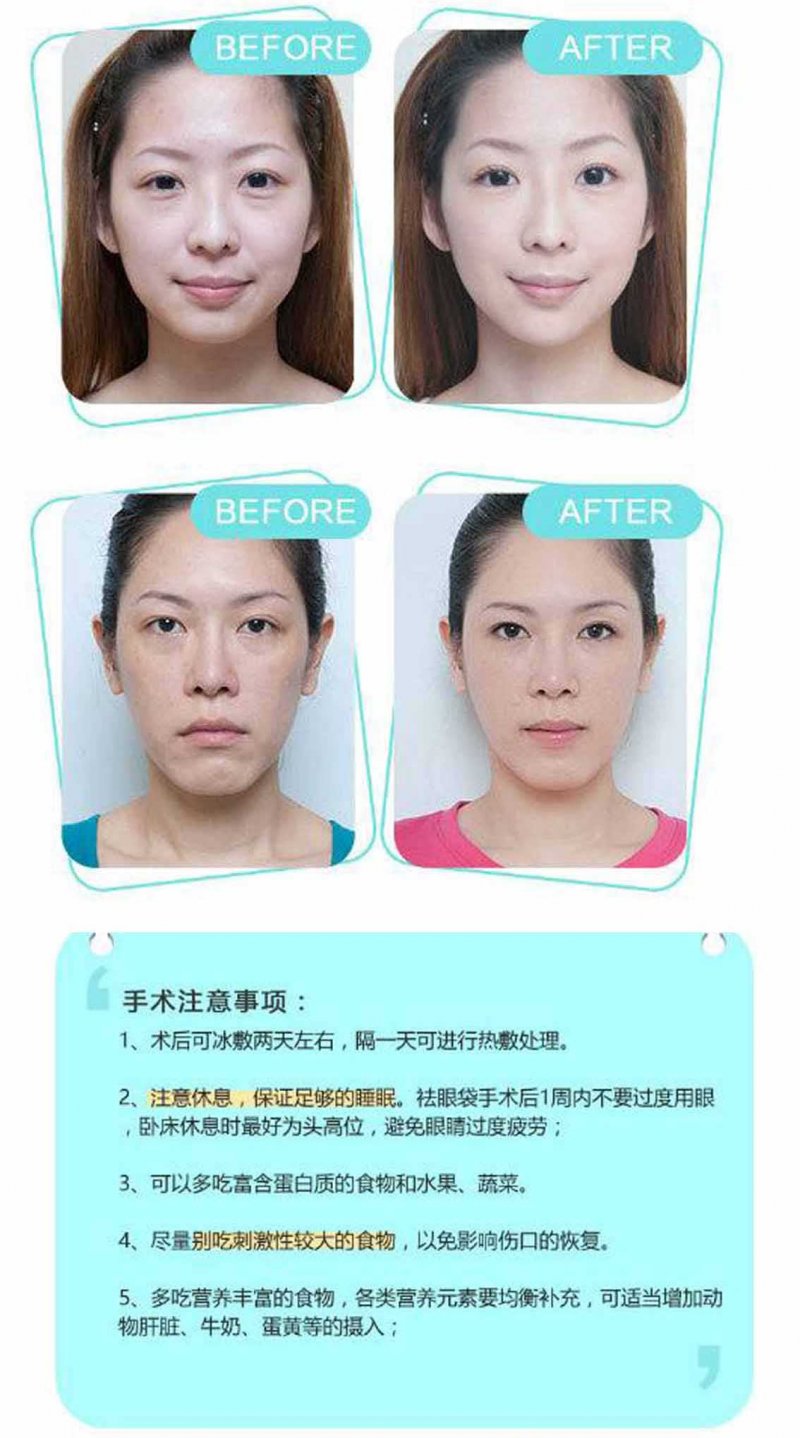https://img.miyanlife.com/mnt/Editor/2017-08-02/59816661c07d1.jpg