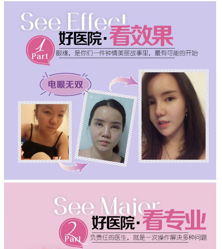https://img.miyanlife.com/mnt/Editor/2017-08-02/598167a4e5646.jpg