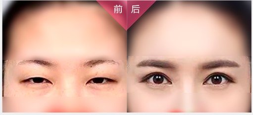 https://img.miyanlife.com/mnt/Editor/2017-08-28/59a3c0eaa469b.jpg