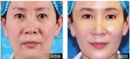 https://img.miyanlife.com/mnt/Editor/2017-08-28/59a3c48d078b8.jpg