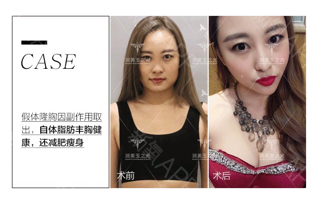 https://img.miyanlife.com/mnt/Editor/2018-10-14/5bc36450c968e.jpg
