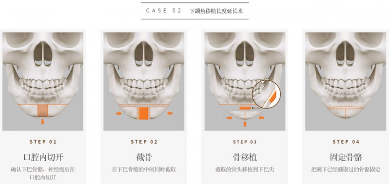 案例图片