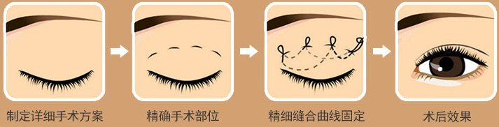 https://img.miyanlife.com/mnt/Editor/2019-02-12/5c6274d5ca69e.jpg