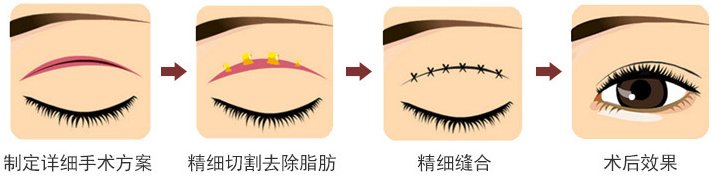 https://img.miyanlife.com/mnt/Editor/2019-02-12/5c6274e637e46.jpg